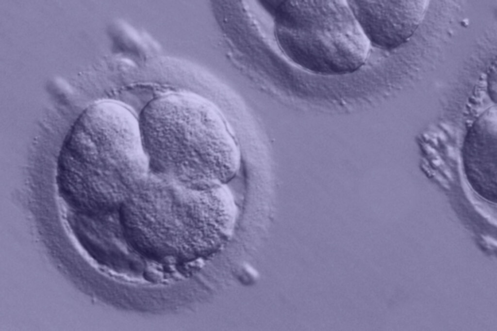 Werden die Gene dieser Embryo-Zellen ein gesundes Kind hervorbringen? Mit Bluttest lässt sich das schon vor der Geburt feststellen. Diese sollen wohl bald von den Krankenkassen bezahlt werden.