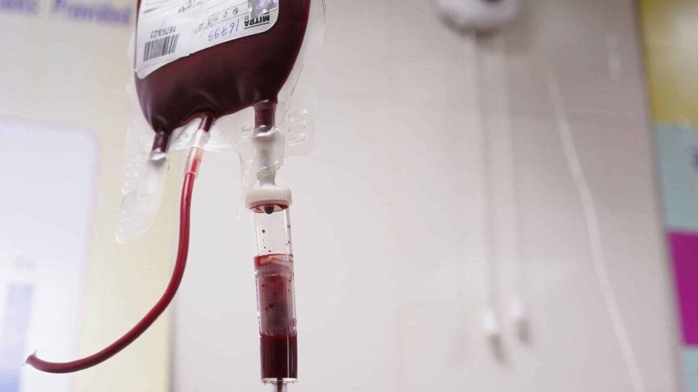 Bluttransfusion